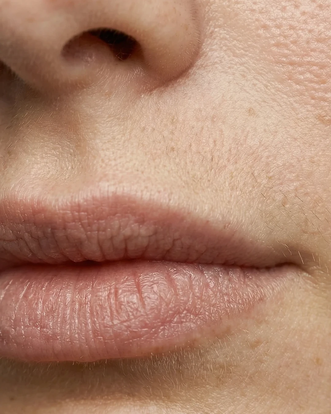 Mouth, image 4 of 4