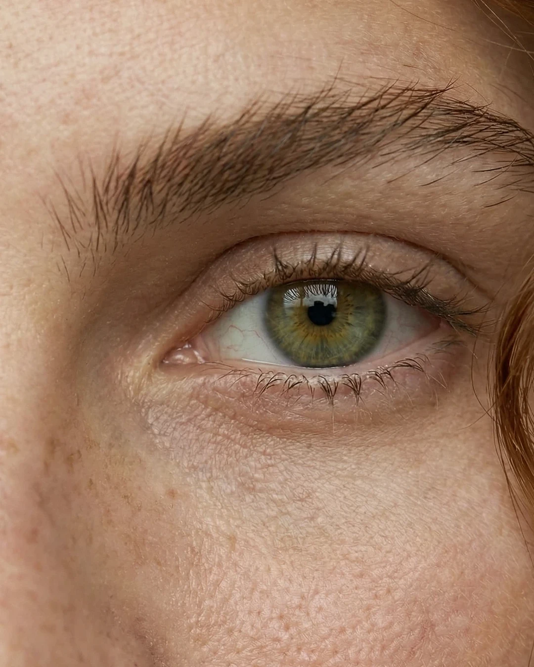 Eye, image 3 of 4